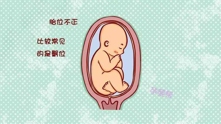 孕期胎位不正怎么办？在这个时间内纠正效果最佳！