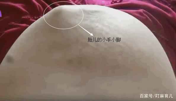 胎儿不停地踹孕妇肚子，是生气了还是不舒服？这3个原因要搞清楚